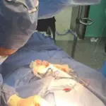 Jornada de marcapasos en el estado Barinas beneficia a 6 pacientes en el Hospital Dr. Samuel Darío Maldonado