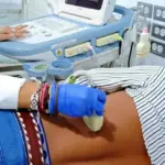 Ministerio de Salud realiza jornada especial de ecosonogramas en el municipio Cedeño estado Monagas