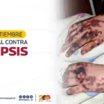 Día Mundial Contra la Sepsis: Una Emergencia que Podemos Prevenir